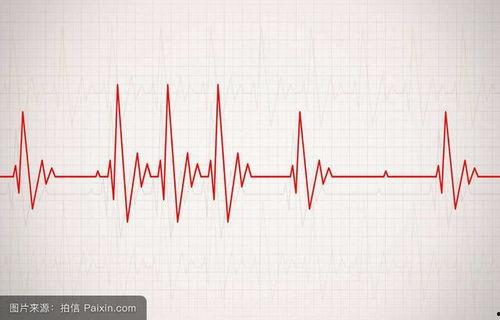 吃瓜齐鲁医院心电图,揭秘健康脉动